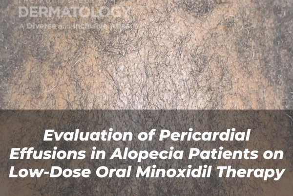 Journal of Drugs in Dermatology JDD article about evaluation of pericardial effusions in alopecia patients on low-dose oral minoxidil therapy