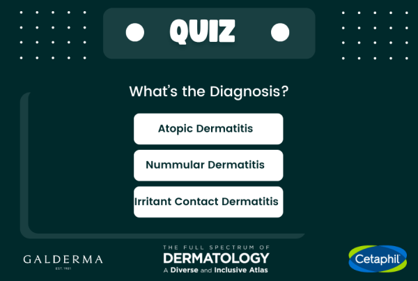 The Full Spectrum of Dermatology: A Diverse and Inclusive Atlas skin pictures. The Inclusive Derm Atlas highlights side by side images of skin conditions of all skin tones and skin types, including skin of color skin tones.