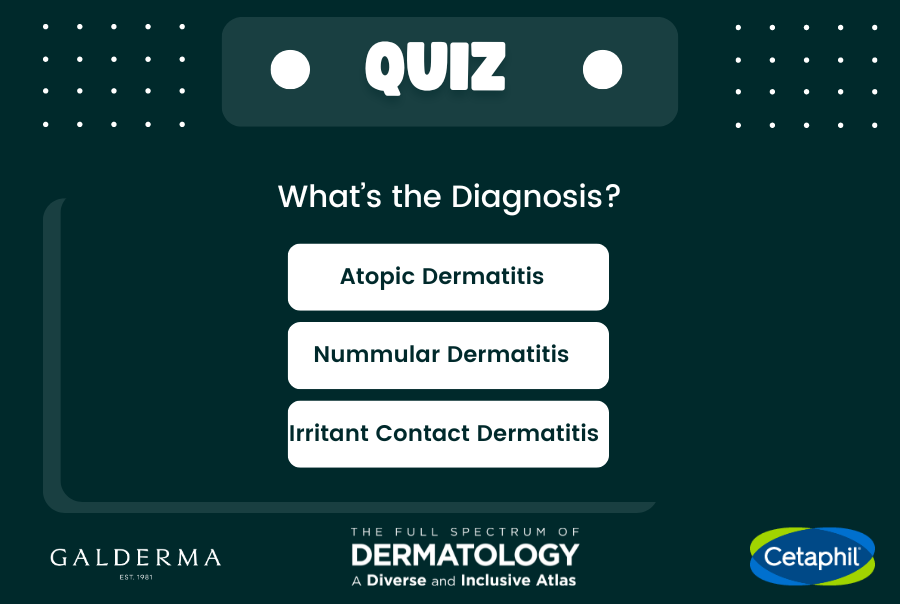 The Full Spectrum of Dermatology: A Diverse and Inclusive Atlas skin pictures. The Inclusive Derm Atlas highlights side by side images of skin conditions of all skin tones and skin types, including skin of color skin tones.