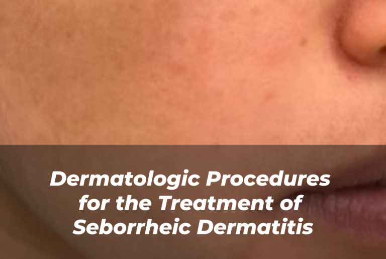 Journal of Drugs in Dermatology JDD article about Dermatologic Procedures for the Treatment of Seborrheic Dermatitis