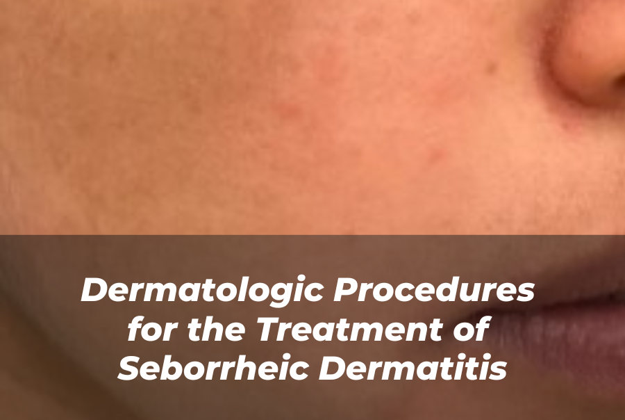 Journal of Drugs in Dermatology JDD article about Dermatologic Procedures for the Treatment of Seborrheic Dermatitis