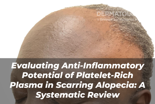 Journal of Drugs in Dermatology JDD Article About Evaluating Anti-Inflammatory Potential of Platelet-Rich Plasma in Scarring Alopecia: A Systematic Review. Image from the Full Spectrum of Dermatology: A Diverse and Inclusive Atlas of hair skin condition, scarring alopecia.