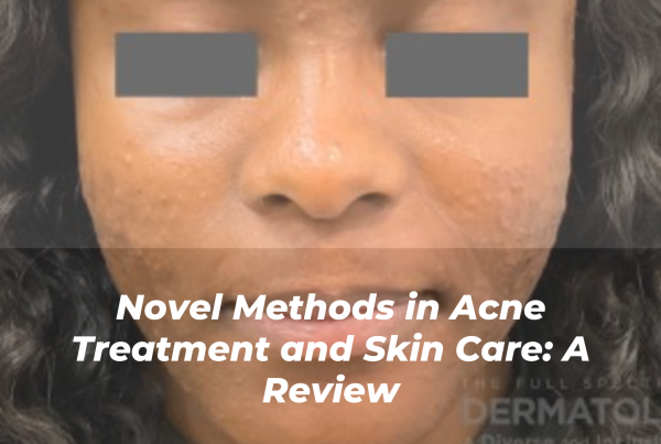 Journal of Drugs in Dermatology JDD Article About Novel Methods in Acne Treatment and Skin Care: A Review. Image from the Full Spectrum of Dermatology: A Diverse and Inclusive Atlas. Acne image of skin of color range from Inclusive Derm Atlas Online Gallery