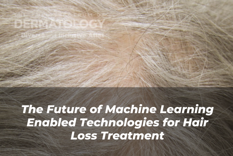 Journal of Drugs in Dermatology JDD Article About The Future of Machine Learning Enabled Technologies for Hair Loss Treatment. Image from the Full Spectrum of Dermatology: A Diverse and Inclusive Atlas. Inclusive Derm Atlas image features a patient with hair loss or androgenic alopecia.