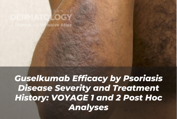 Journal of Drugs in Dermatology JDD Article About Guselkumab Efficacy by Psoriasis Disease Severity and Treatment History: VOYAGE 1 and 2 Post Hoc Analyses. Image from the Full Spectrum of Dermatology: A Diverse and Inclusive Atlas of a darker skin tone elbow with psoriasis.