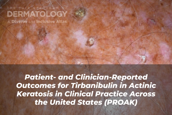 Journal of Drugs in Dermatology JDD Article About Patient- and Clinician-Reported Outcomes for Tirbanibulin in Actinic Keratosis in Clinical Practice Across the United States (PROAK). Image is from the Full Spectrum of Dermatology: A Diverse and Inclusive Atlas of a skin tone with actinic keratosis (AK).