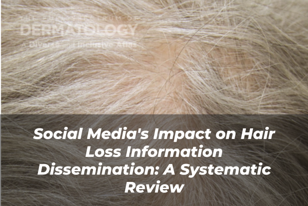 Journal of Drugs in Dermatology JDD Article About Social Media's Impact on Hair Loss Information Dissemination: A Systematic Review. Image from the Full Spectrum of Dermatology: A Diverse and Inclusive Atlas. Alopecia image of skin of color range from Inclusive Derm Atlas Online Gallery