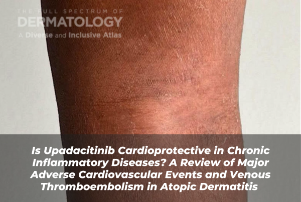 Journal of Drugs in Dermatology JDD Article About Is Upadacitinib Cardioprotective in Chronic Inflammatory Diseases? A Review of Major Adverse Cardiovascular Events and Venous Thromboembolism in Atopic Dermatitis. Image is from the Full Spectrum of Dermatology: A Diverse and Inclusive Atlas of a darker skin tone with atopic dermatitis (AD) on their arm.