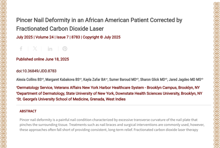 Journal of Drugs in Dermatology JDD Article About Pincer Nail Deformity in an African American Patient Corrected by Fractionated Carbon Dioxide Laser