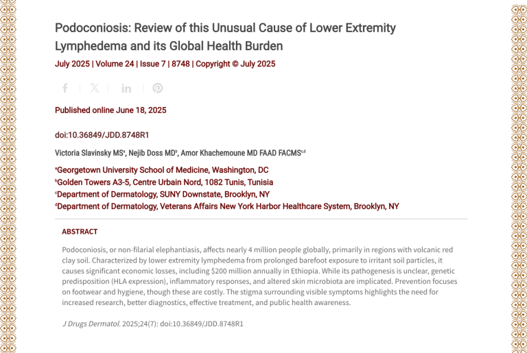 Journal of Drugs in Dermatology JDD Article About Podoconiosis: Review of this Unusual Cause of Lower Extremity Lymphedema and its Global Health Burden