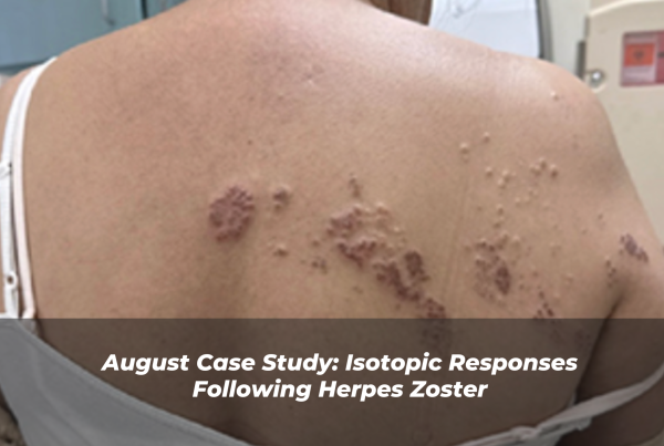 Journal of Drugs in Dermatology JDD Article About Isotopic Responses Following Herpes Zoster