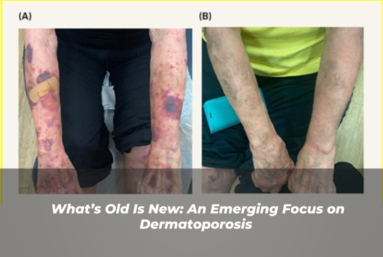 Journal of Drugs in Dermatology JDD Article About What’s Old Is New: An Emerging Focus on Dermatoporosis