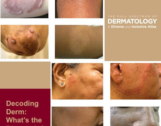 Journal of Drugs in Dermatology JDD About The Full Spectrum of Dermatology: A Diverse and Inclusive Atlas. The images is of sarcoidosis among different skin tones