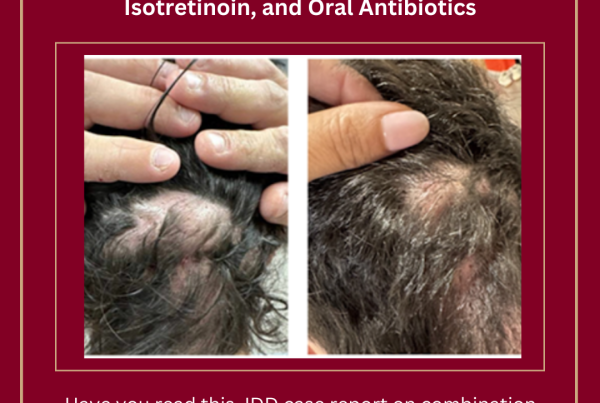 Journal of Drugs in Dermatology JDD Article about Treatment Strategy for Refractory Dissecting Cellulitis of the Scalp Using Bimekizumab, Isotretinoin, and Oral Antibiotics