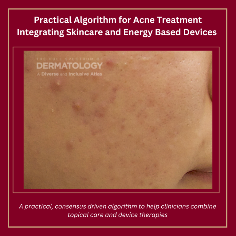 Journal of Drugs in Dermatology JDD Article about Practical Algorithm for Acne Treatment Integrating Skincare and Energy Based Devices