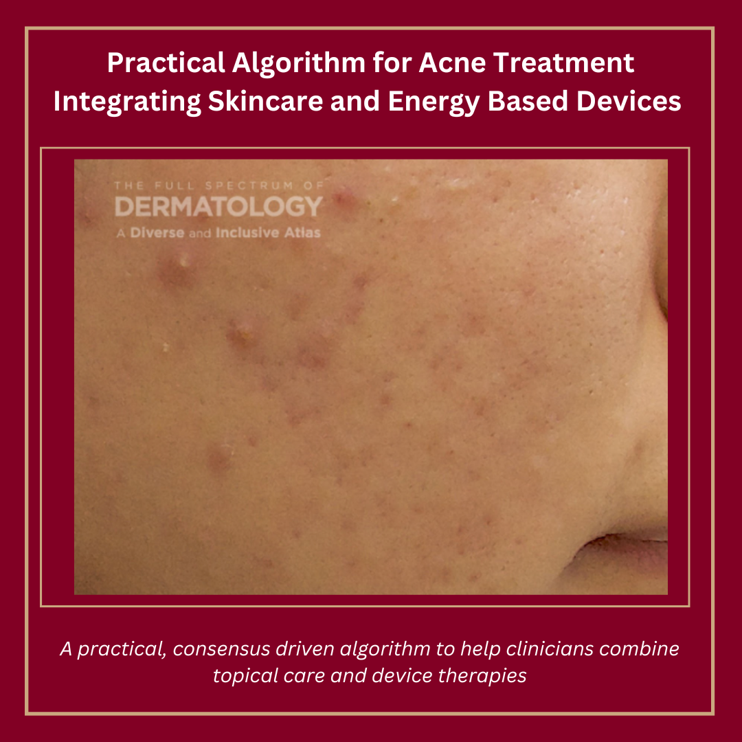Journal of Drugs in Dermatology JDD Article about Practical Algorithm for Acne Treatment Integrating Skincare and Energy Based Devices