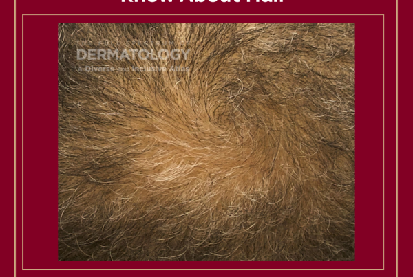 Journal of Drugs in Dermatology JDD Article about Exploring the Potential Link Between Minoxidil Use and Rosacea Using A Real-World Data Base