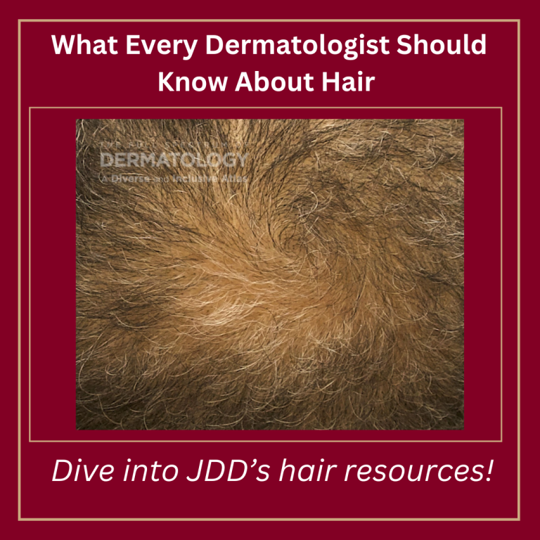 Journal of Drugs in Dermatology JDD Article about Exploring the Potential Link Between Minoxidil Use and Rosacea Using A Real-World Data Base