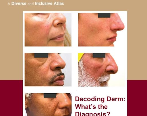 Journal of Drugs in Dermatology JDD About The Full Spectrum of Dermatology: A Diverse and Inclusive Atlas. The images is of rosacea among different skin tones