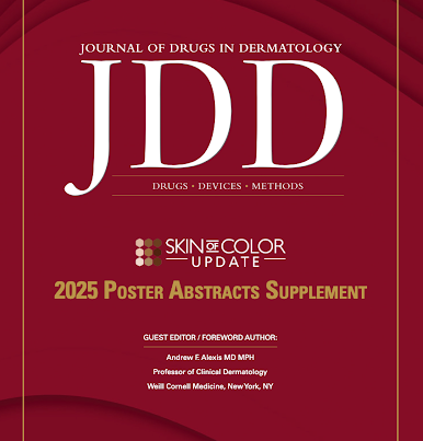 Journal of Drugs in Dermatology JDD cover featuring SOCU 2025 Poster Abstract Supplement, published in April by our team as the official SOCU media partner. Explore more than 70 abstracts covering alopecia areata, pigmentary disorders, keloids, pediatric dermatology, equity in dermatology and other topics relevant to skin of color.