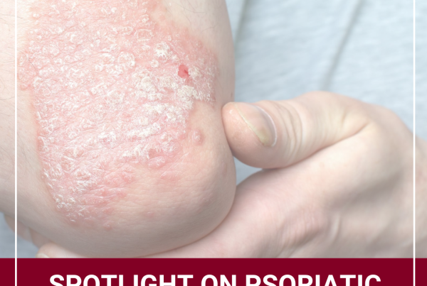 Journal of Drugs in Dermatology JDD About Psoriatic Arthritis Awareness Month
