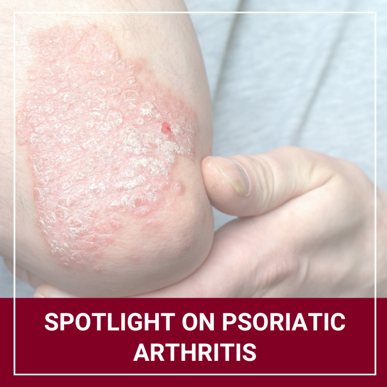Journal of Drugs in Dermatology JDD About Psoriatic Arthritis Awareness Month
