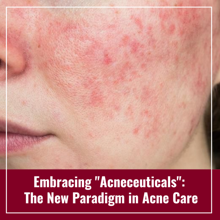 Journal of Drugs in Dermatology JDD featuring Embracing "Acneceuticals": The New Paradigm in Acne Care
