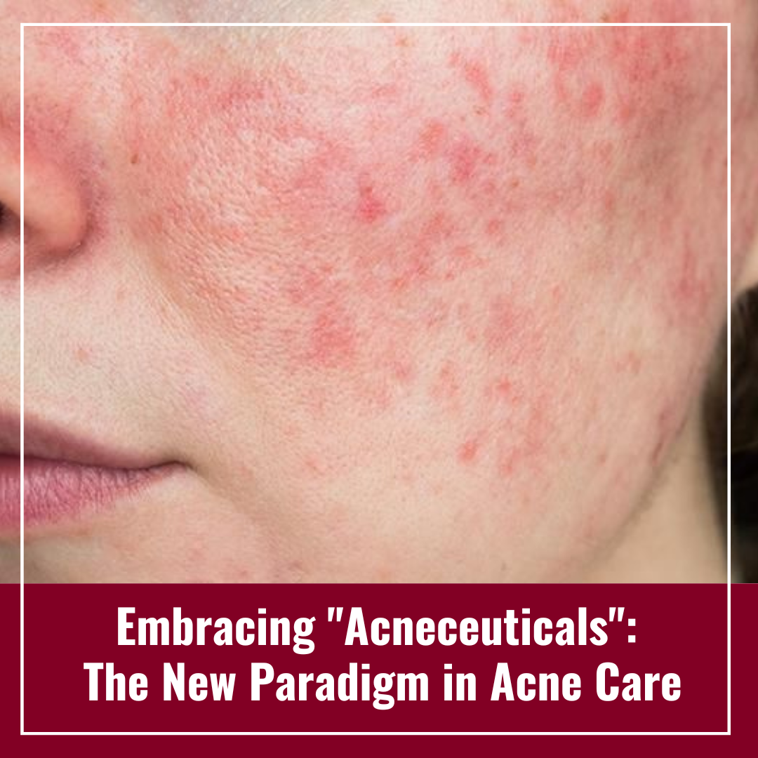 Journal of Drugs in Dermatology JDD featuring Embracing "Acneceuticals": The New Paradigm in Acne Care