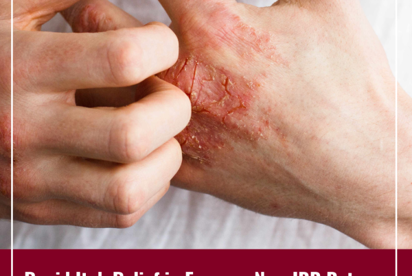 Journal of Drugs in Dermatology JDD featuring Clinical Characteristics and Time to Onset of JAK-Inhibitor-Associated Acne: A Retrospective Chart Review Study