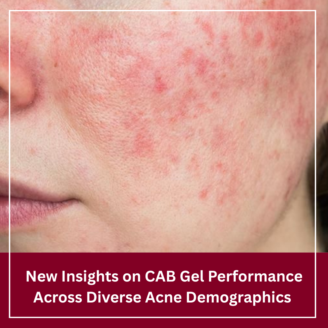 Journal of Drugs in Dermatology JDD featuring Clindamycin Phosphate 1.2%/Adapalene 0.15%/Benzoyl Peroxide 3.1% Gel for Acne: Pooled Analysis by Age and Sex