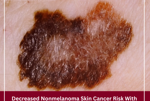 Journal of Drugs in Dermatology JDD featuring Decreased Nonmelanoma Skin Cancer Risk With Interleukin-17 and Interleukin-23 Inhibitors Versus TNF-α Inhibitors in Psoriasis