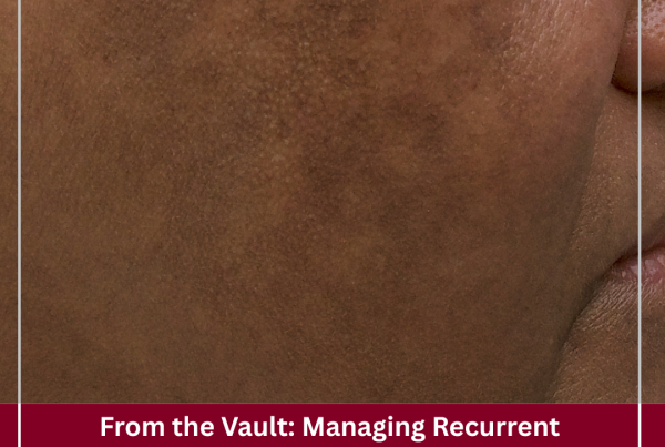 Journal of Drugs in Dermatology JDD featuring Optimizing Melasma Management With Topical Tranexamic Acid: An Expert Consensus