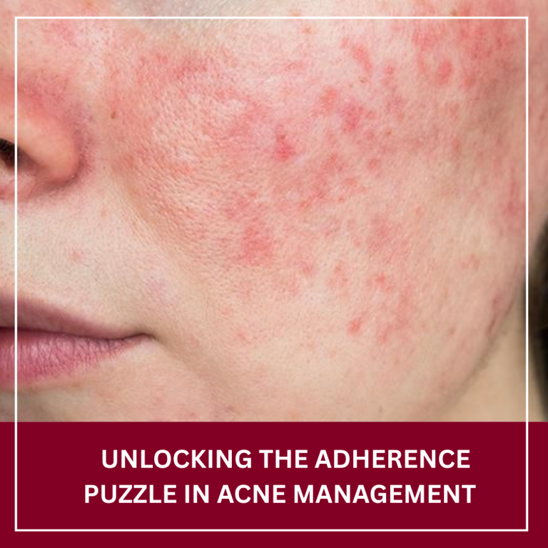 Journal of Drugs in Dermatology JDD featuring Treatment Adherence in Patients With Acne Vulgaris: A Narrative Review