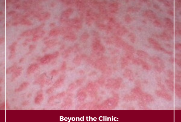 Journal of Drugs in Dermatology JDD Article About From the Vault: Taking A Look At Psoriatic Arthritis