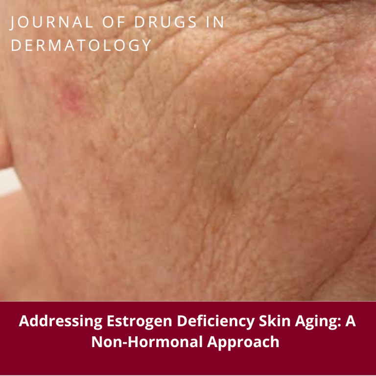 Journal of Drugs in Dermatology JDD featuring Injectable NASHA Gel Skinbooster for Facial Skin Aging in Premenopausal and Postmenopausal Women With Estrogen Deficiency-Associated Not Receiving Hormone Therapy: A Case Series