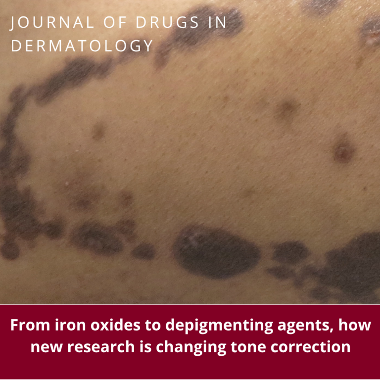 Journal of Drugs in Dermatology JDD featuring Beyond the Dark Spot: Modern Strategies for Stubborn Hyperpigmentation