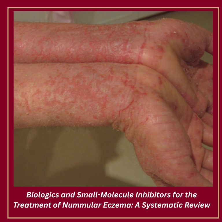 Journal of Drugs in Dermatology JDD featuring Biologics and Small-Molecule Inhibitors for the Treatment of Nummular Eczema: A Systematic Review